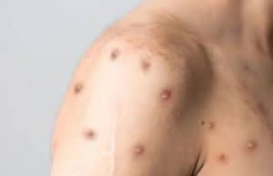 Generic placeholder image